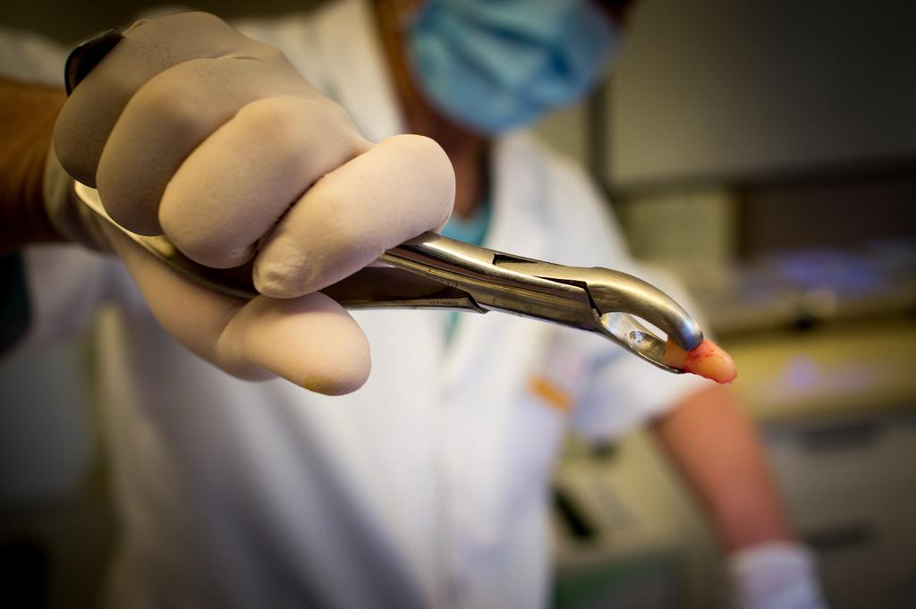 医学医疗牙医拔牙背景图片