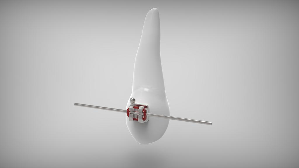 医学医疗畸齿矫正术线背景图片