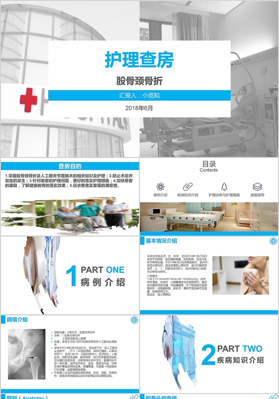 蓝色课件股骨颈骨折护理查房PPT模板