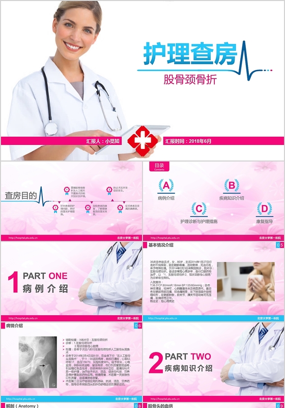 粉色课件股骨颈骨折护理查房PPT模板