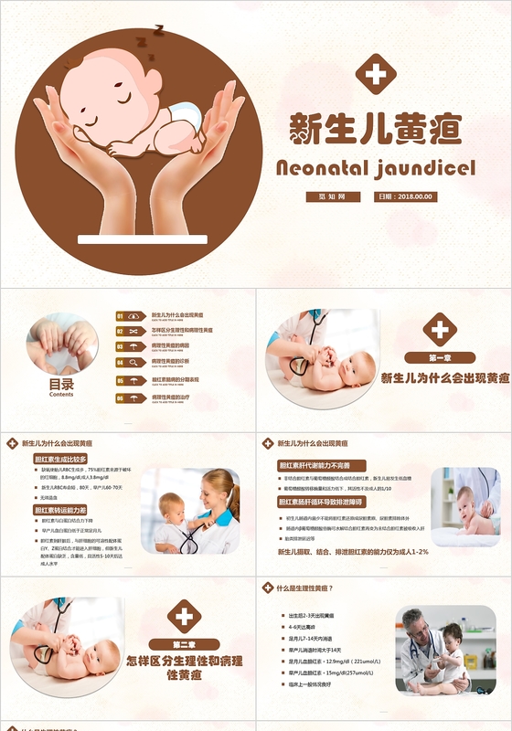 卡通新生儿黄疸知识科普医疗培训PPT模板