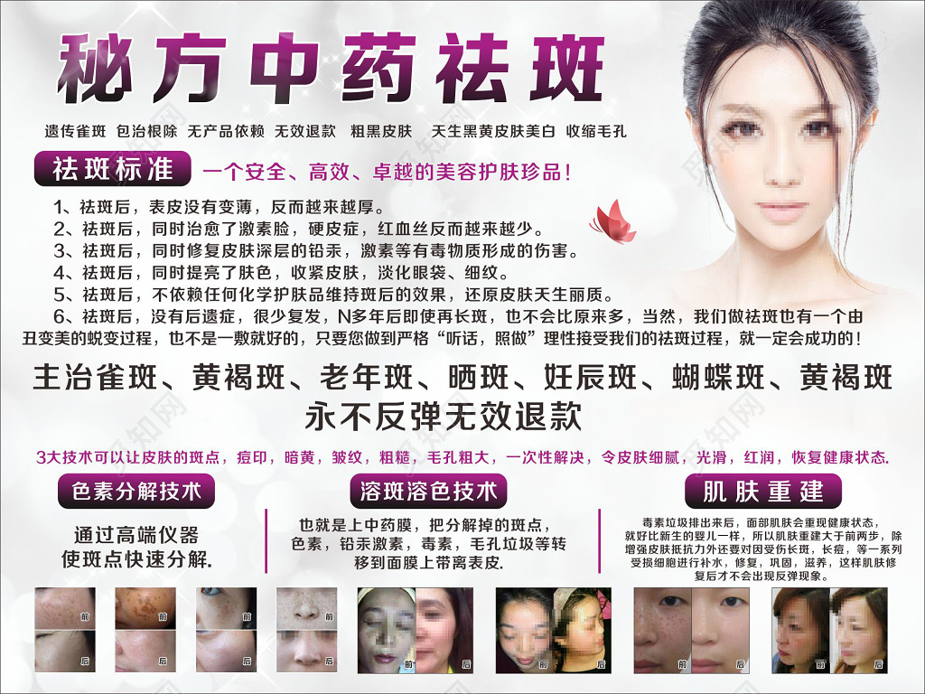 秘方重要祛斑祛斑产品展板
