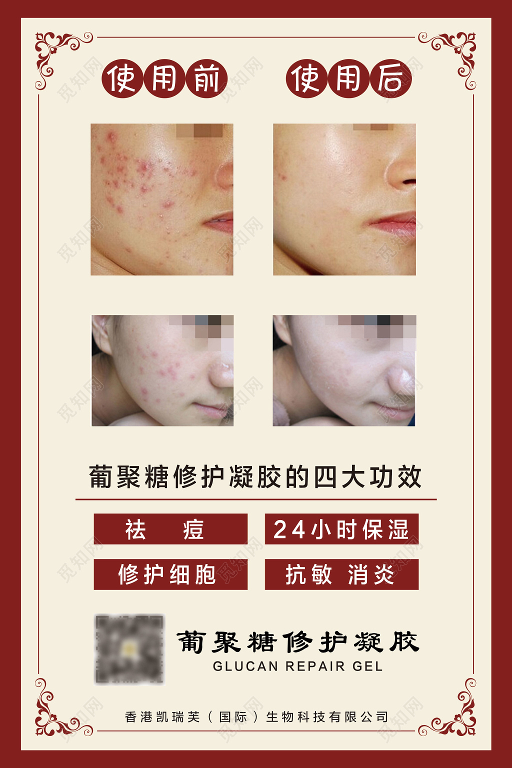 祛痘使用前使用后对比保湿修护细胞抗敏消炎海报设计