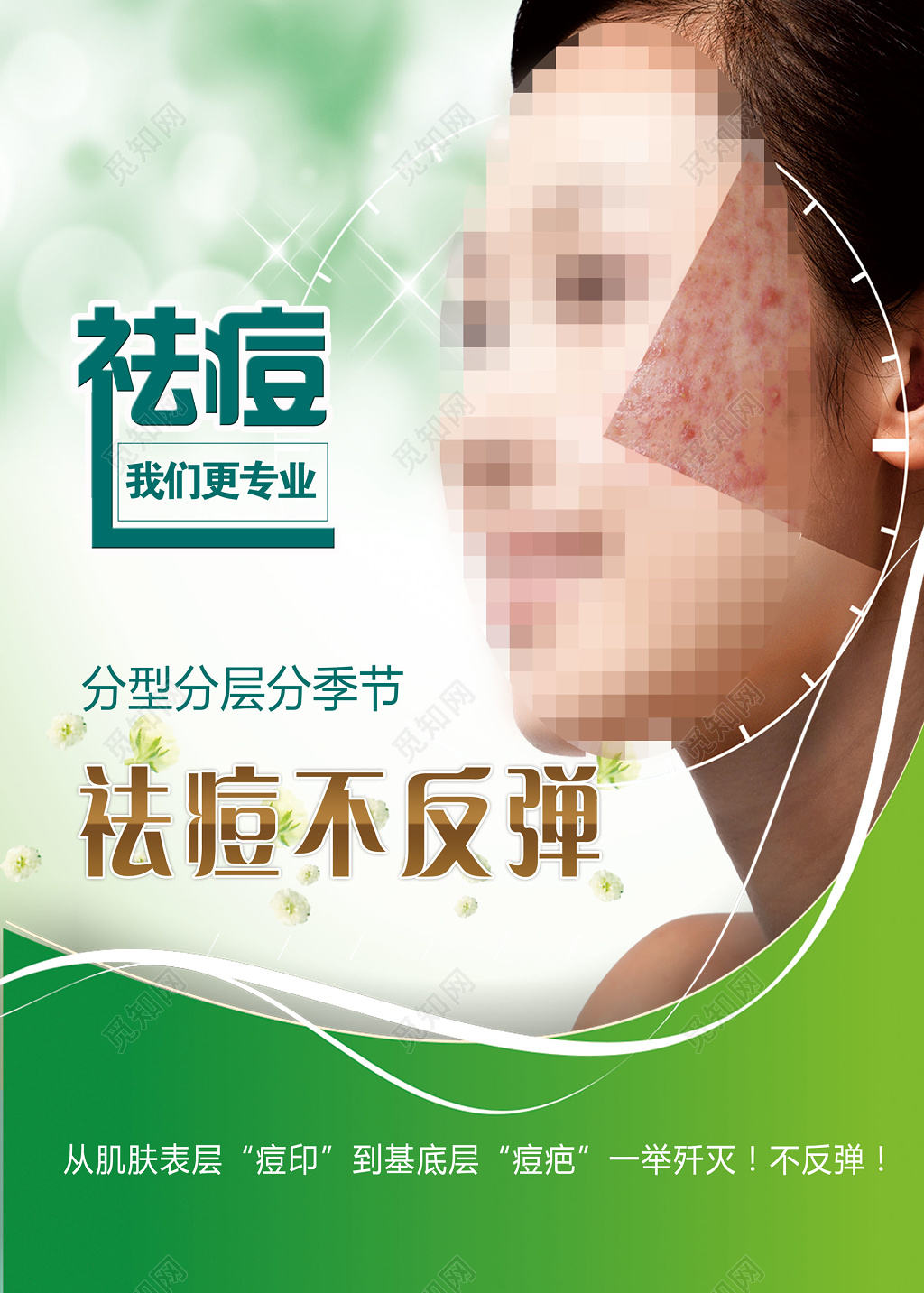 祛痘我们更专业祛痘不反弹美容养生海报设计