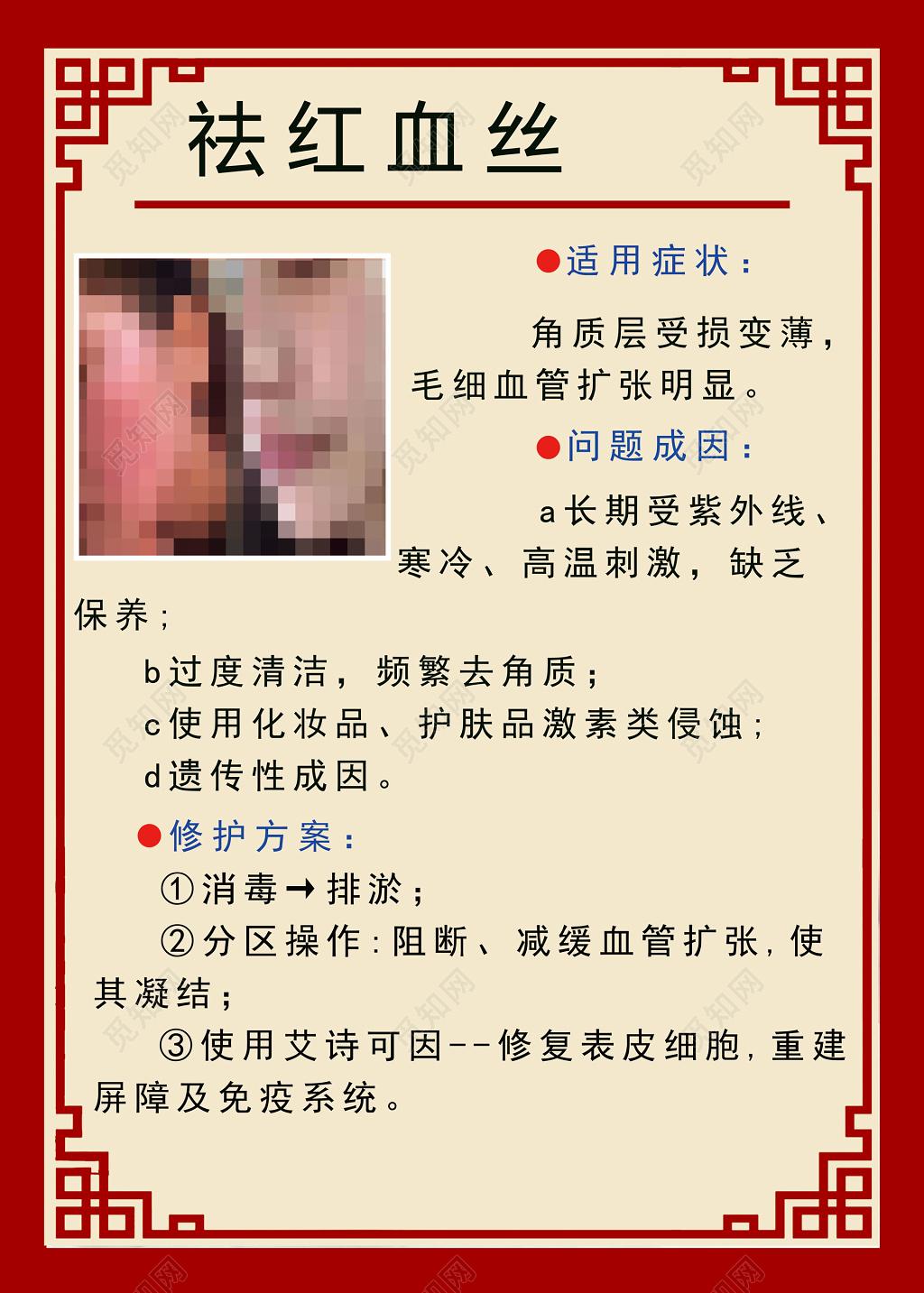 祛红血丝中国风简约海报设计