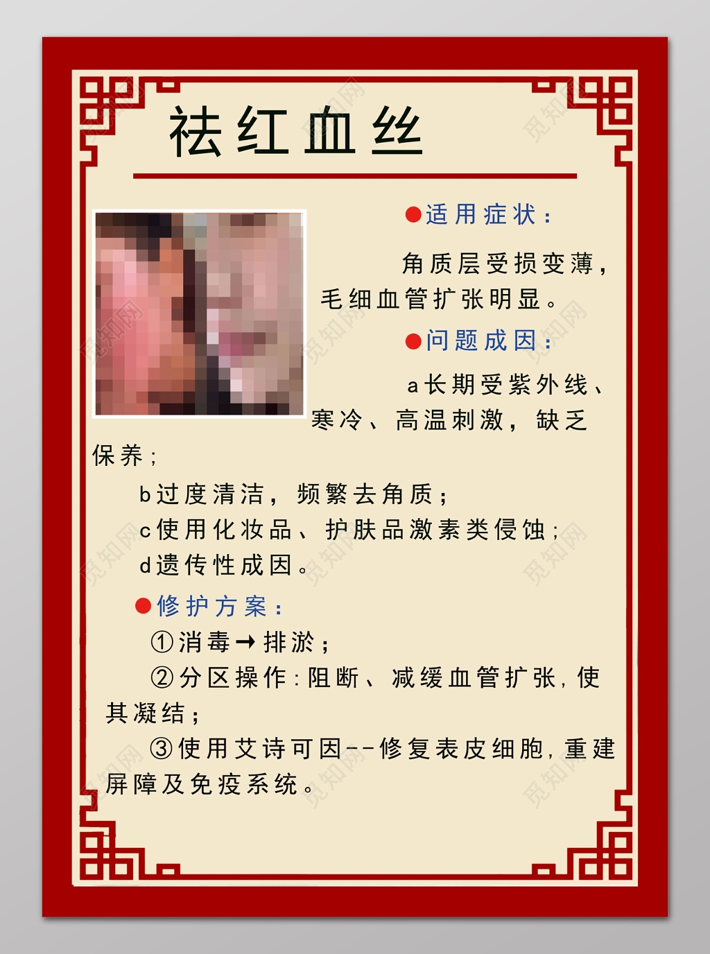 祛红血丝中国风简约海报设计