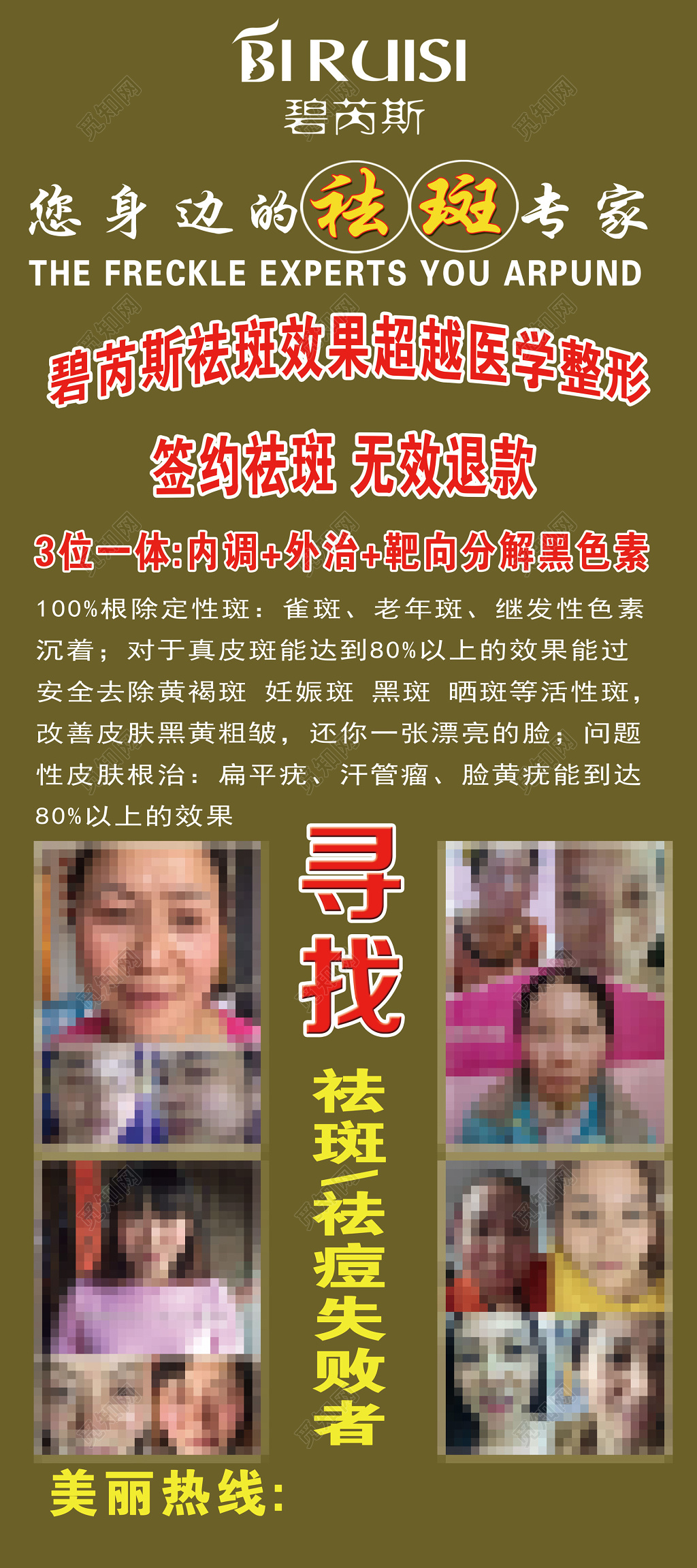 您身边的祛斑专家签约祛斑无效退款祛斑海报设计