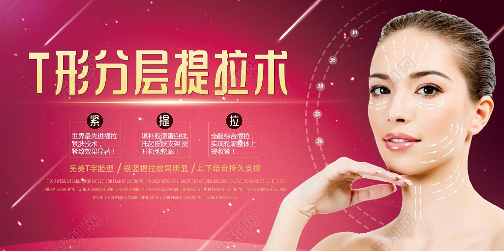整形医院T形分层提拉术整形展板