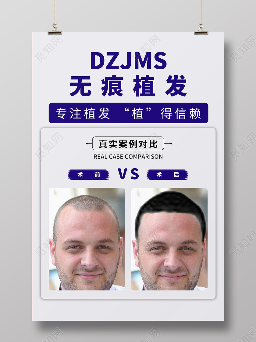 简约大气灰色系无痕植发海报宣传海报