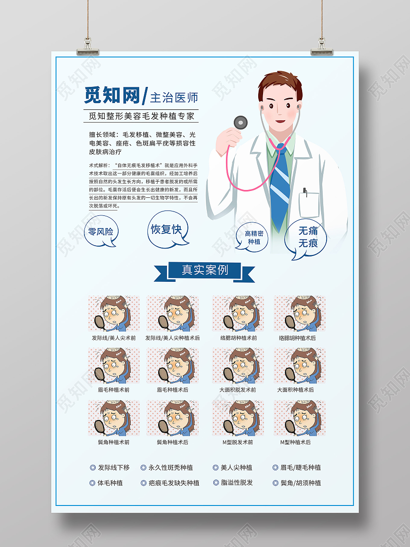 白色简约医生毛发种植头发医美海报宣传植发