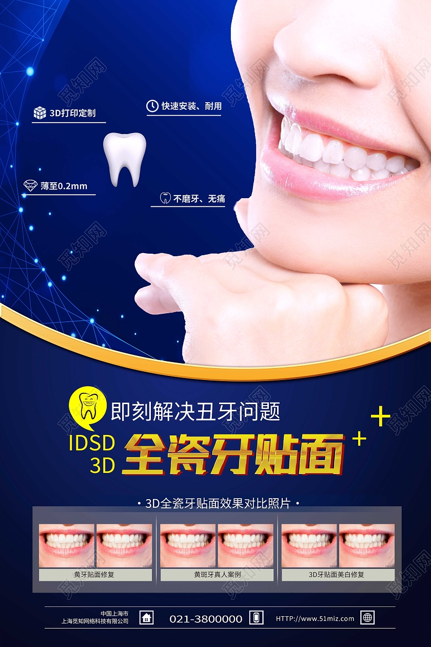 蓝色简约全瓷牙贴面牙齿贴面海报