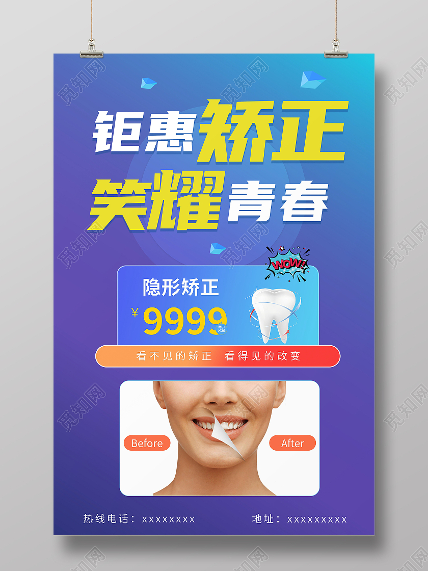 简约钜惠矫正笑耀青春牙齿活动海报牙齿正畸