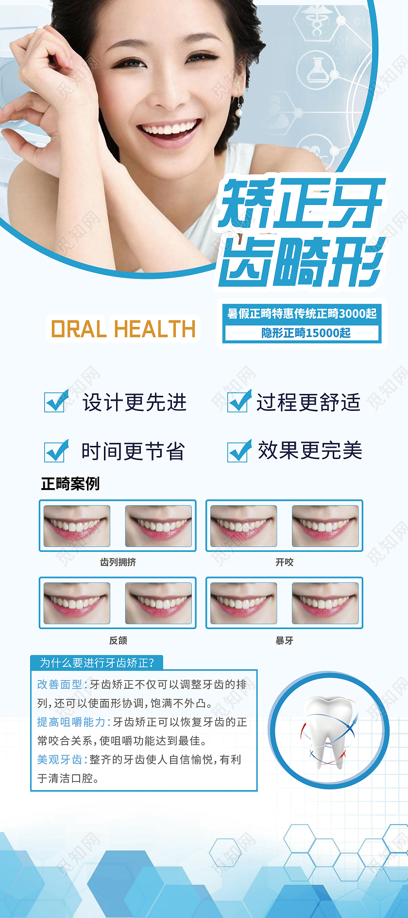 简约大气蓝色系矫正牙齿畸形牙齿正畸展架易拉宝