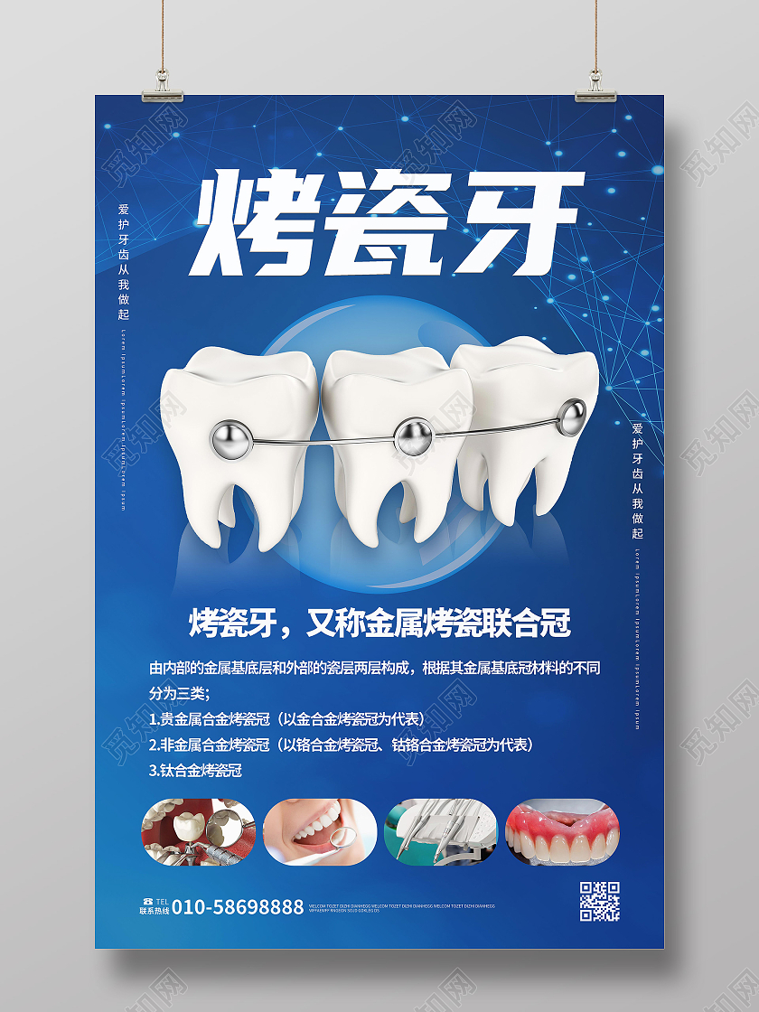 深蓝色创意卡通风格烤瓷牙牙科宣传海报设计烤瓷牙海报