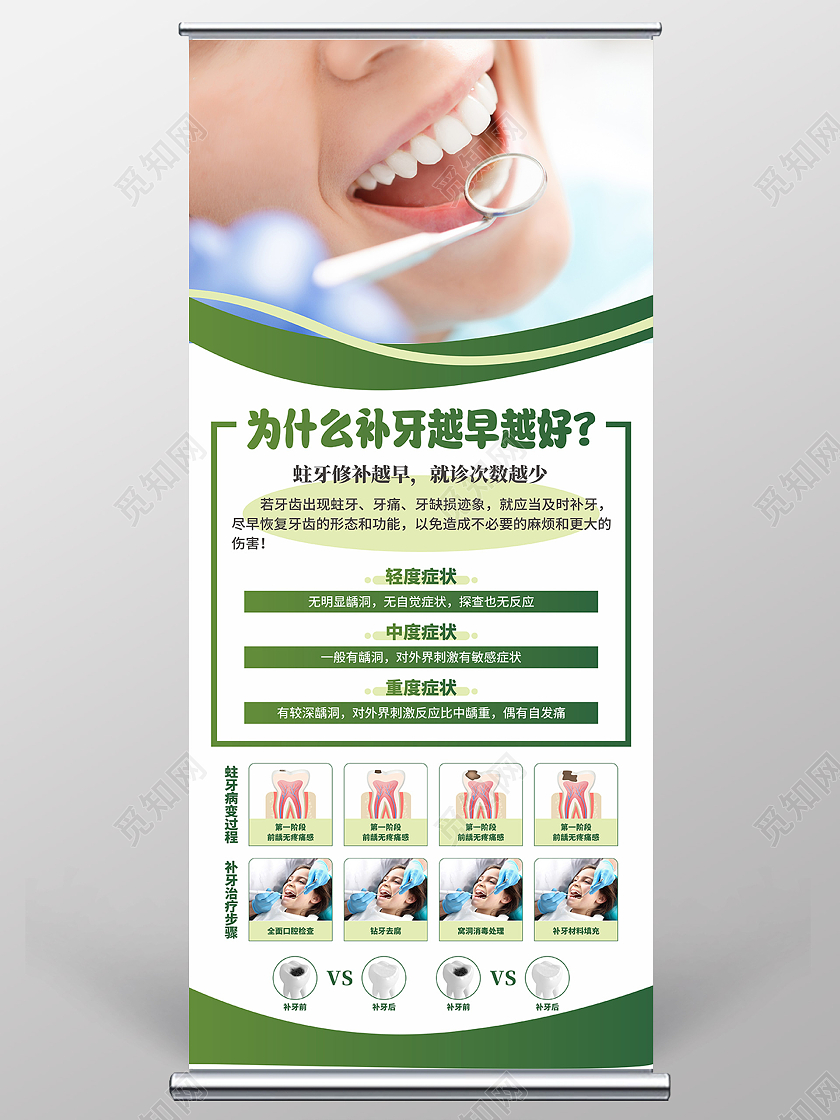 口腔牙科蛀牙补牙海报展架易拉宝补牙易拉宝