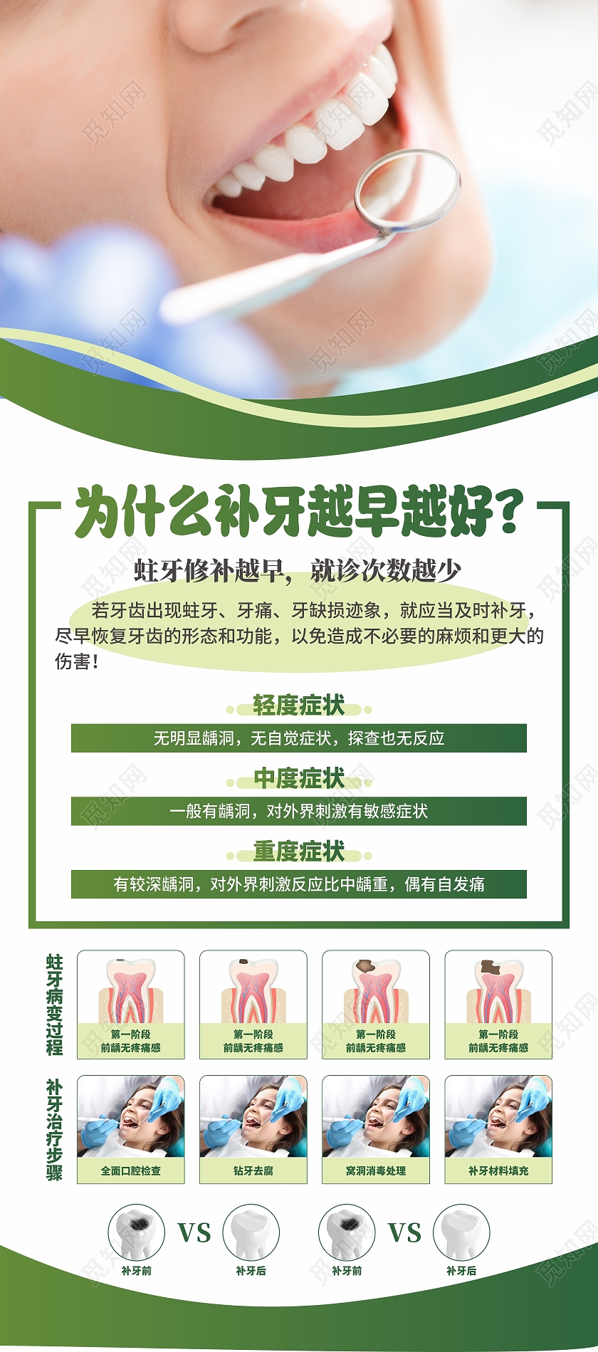 口腔牙科蛀牙补牙海报展架易拉宝补牙易拉宝