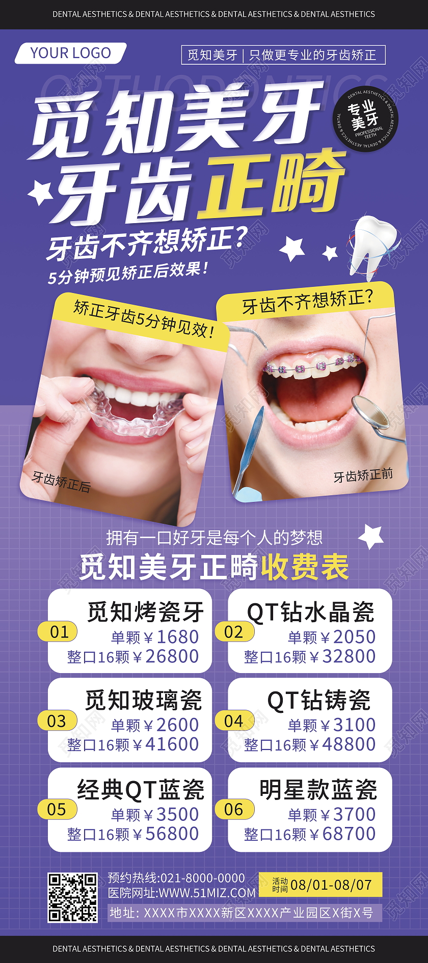 牙齿正畸口腔宣传海报牙齿正畸海报牙齿矫正易拉宝牙齿正畸易拉宝