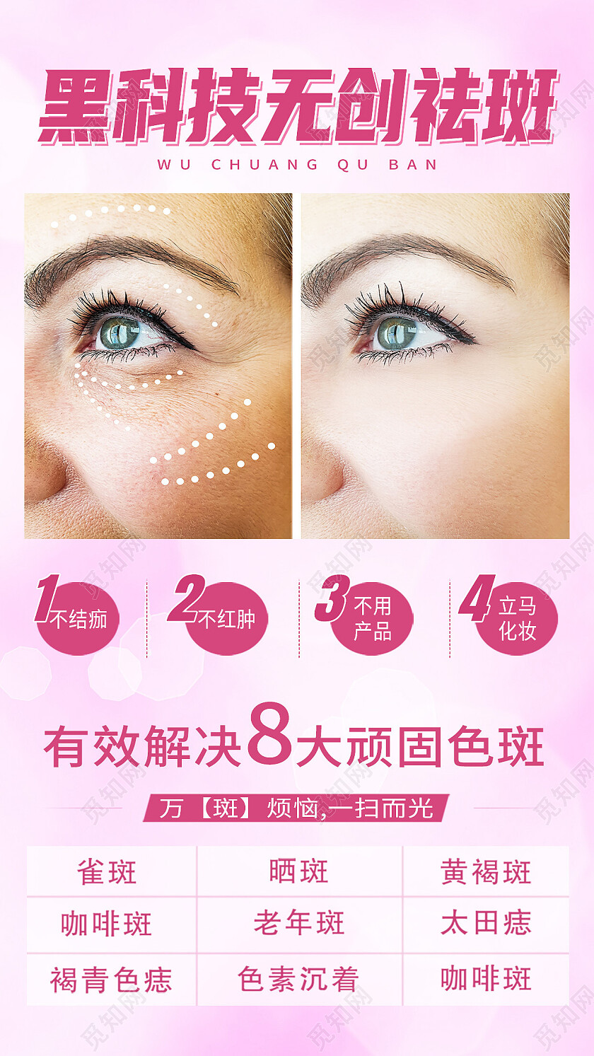 红色简约黑科技无创祛斑雀斑手机宣传海报