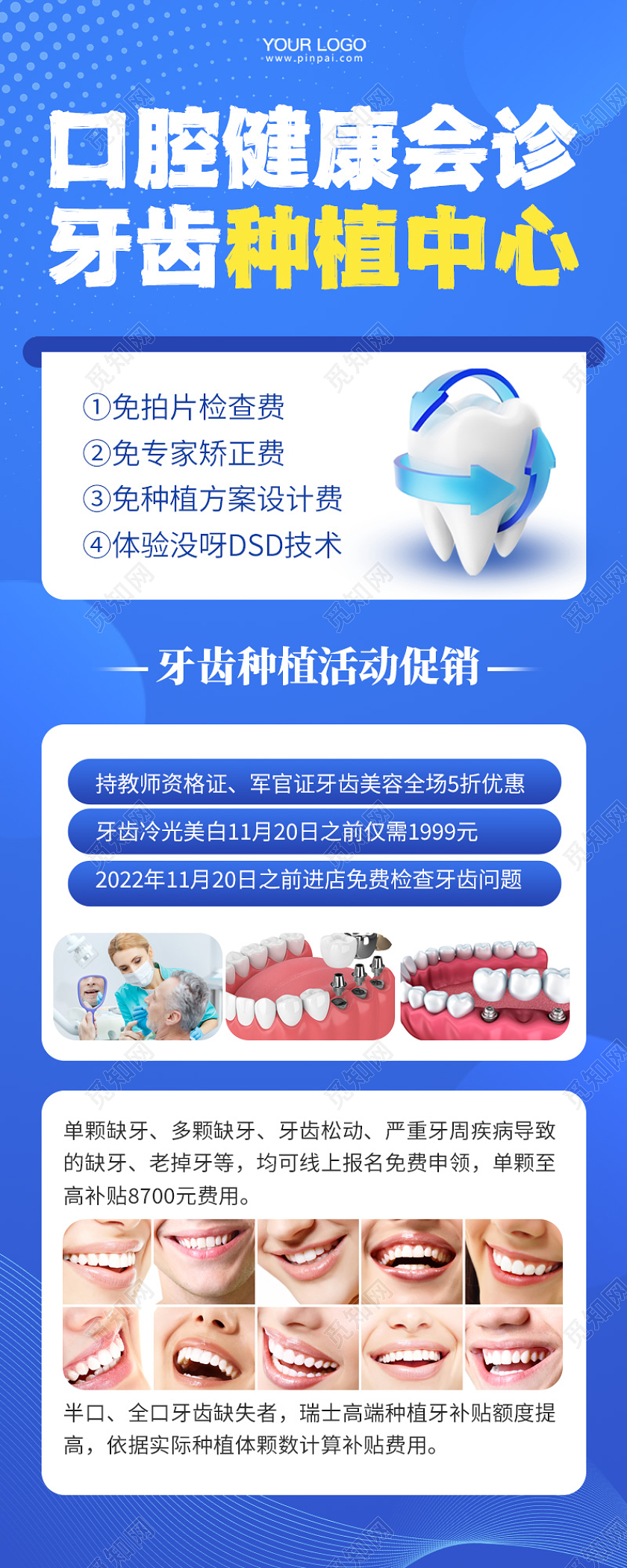 口腔健康牙齿种植活动促销手机长图