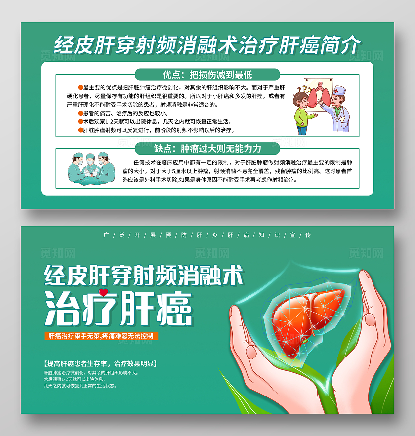 绿色简约经皮肝穿射频消融术治疗肝癌知识科普宣传栏