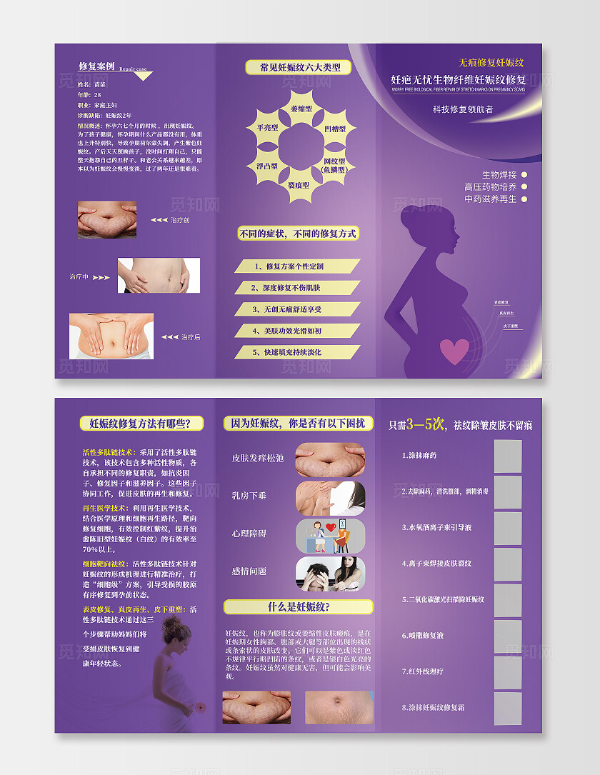 紫色女性健康妊娠纹产后肥胖三折页