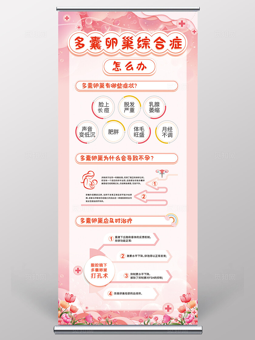 粉色温馨2024多襄卵巢综合证易拉宝多囊卵巢