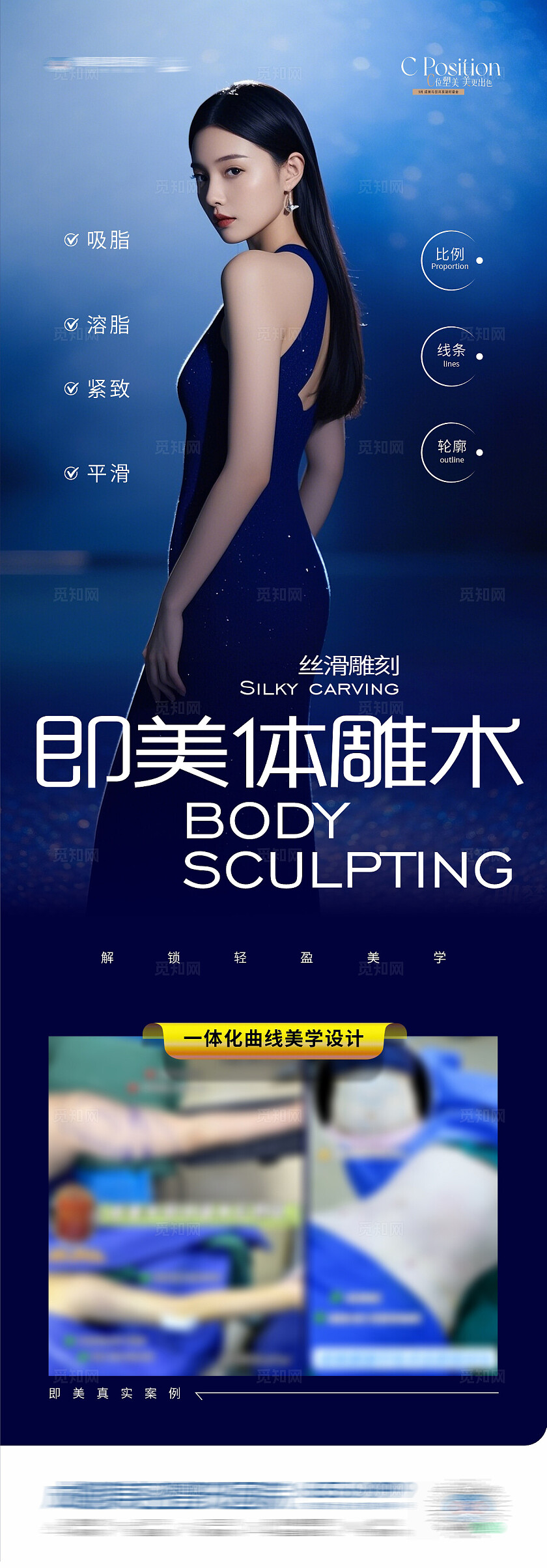 医美体雕术吸脂S型案例长图海报