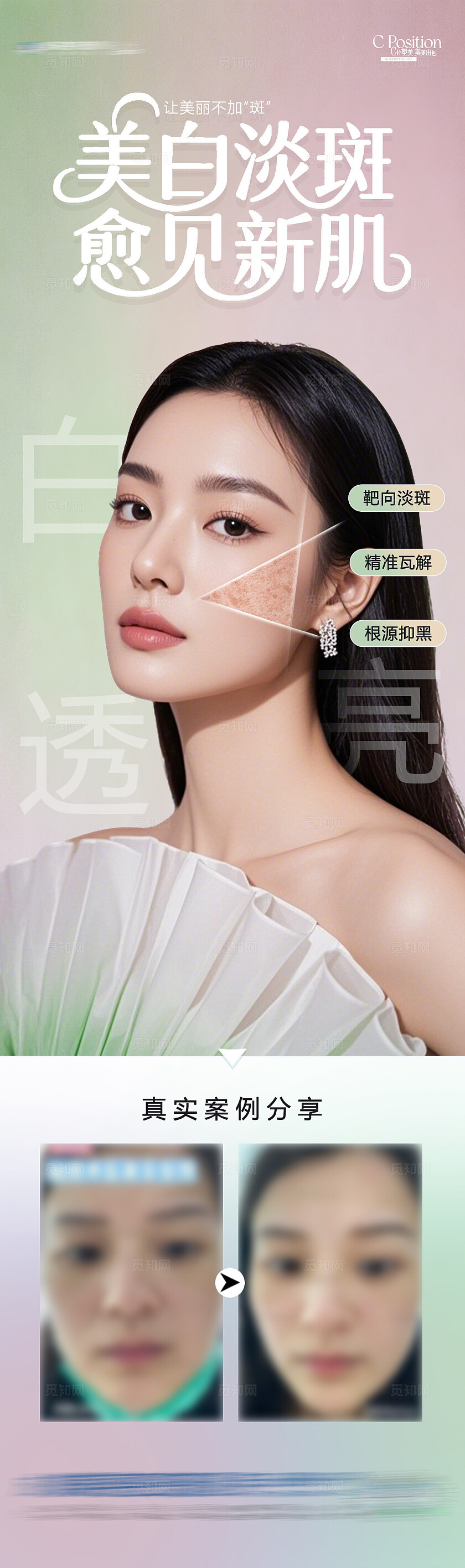 医美美白淡斑提亮美肤案例创意长图海报