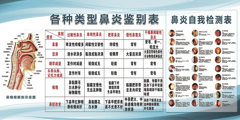鼻炎鉴别表