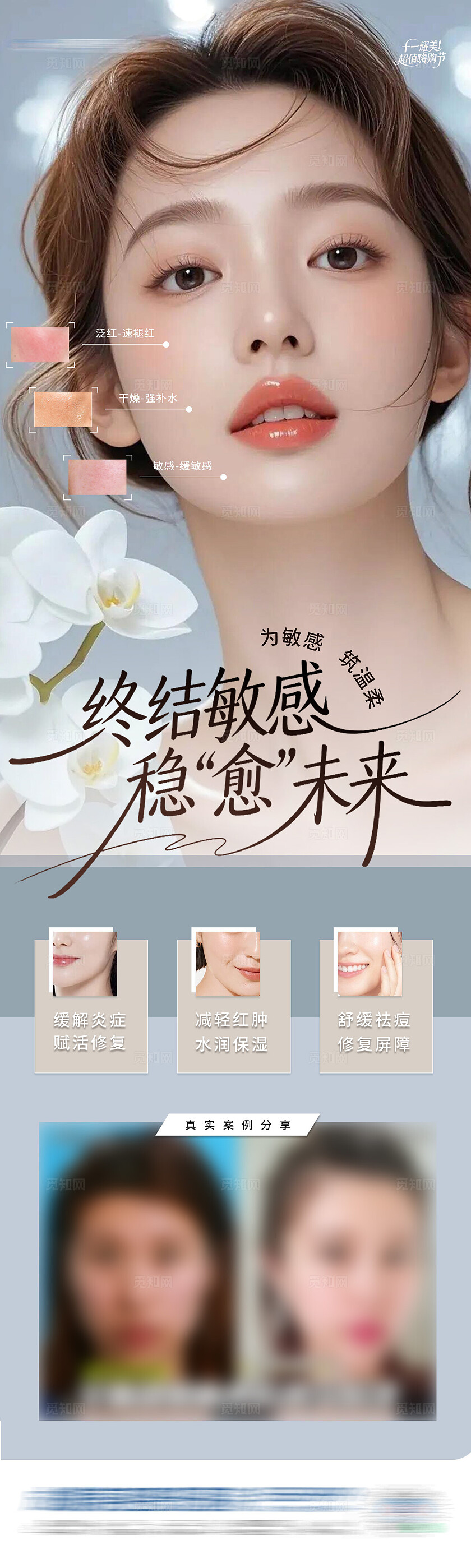 医美敏感修复案例对比创意长图海报