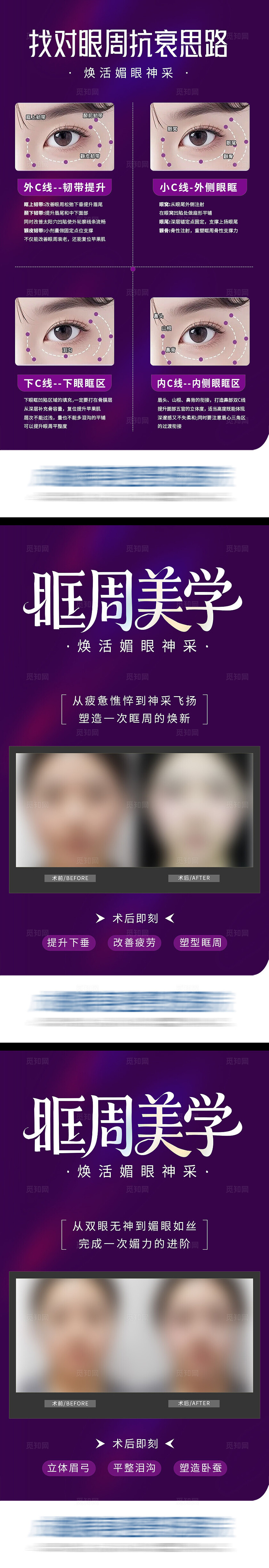 医美眼眶眼周抗衰美学案例科普创意系列海报