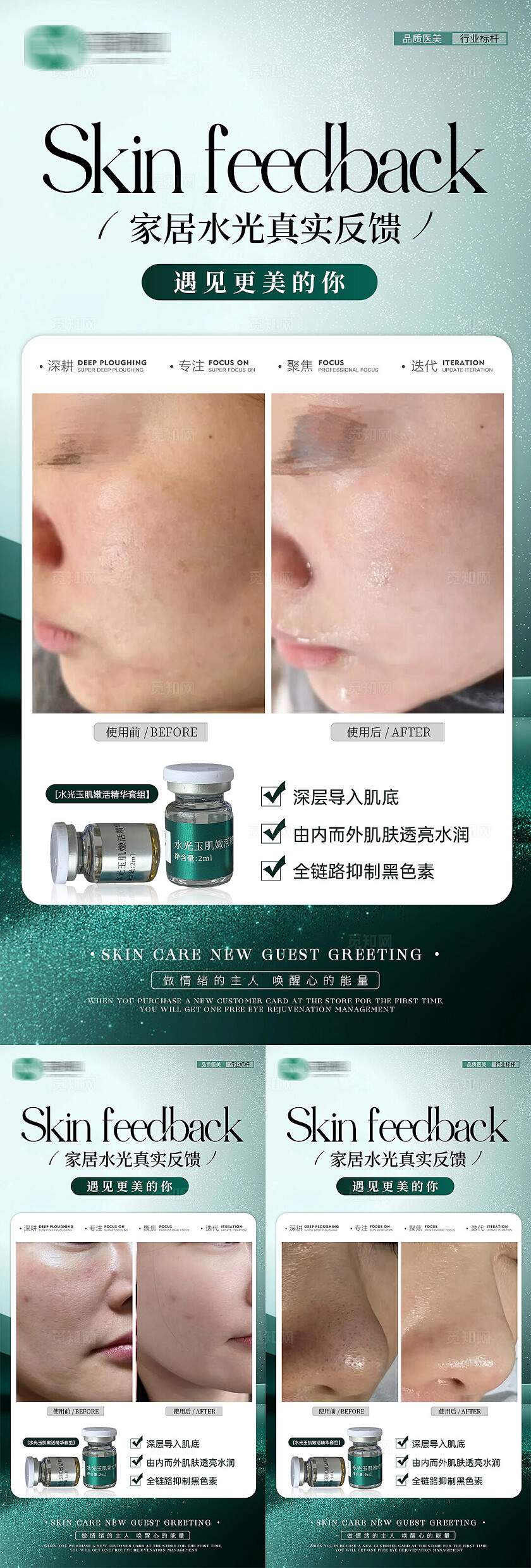 医美案例对比图产品海报