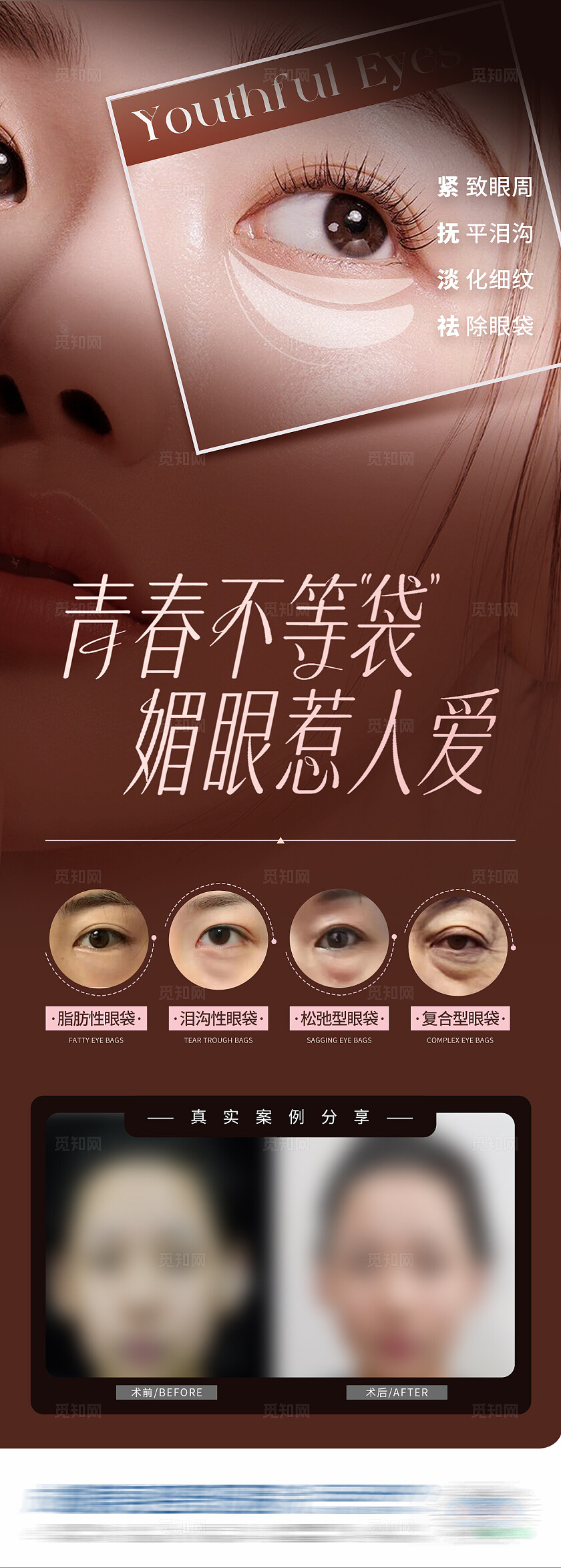 医美三联祛眼袋眼部创意海报