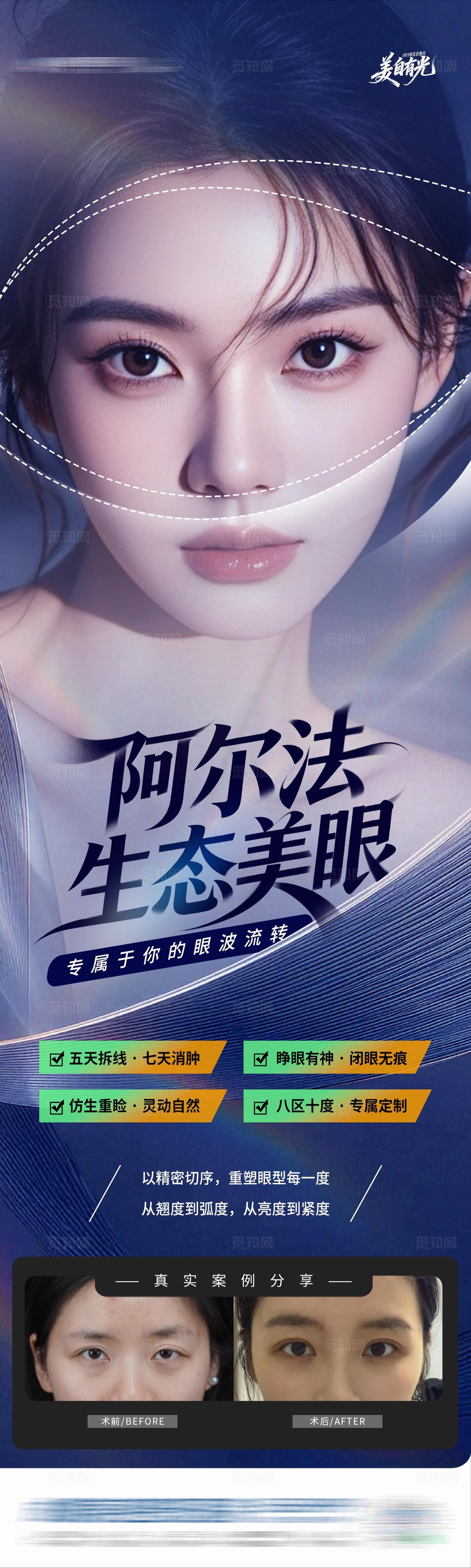 医美阿尔法生态美眼眼部整形案例对比图创意海报