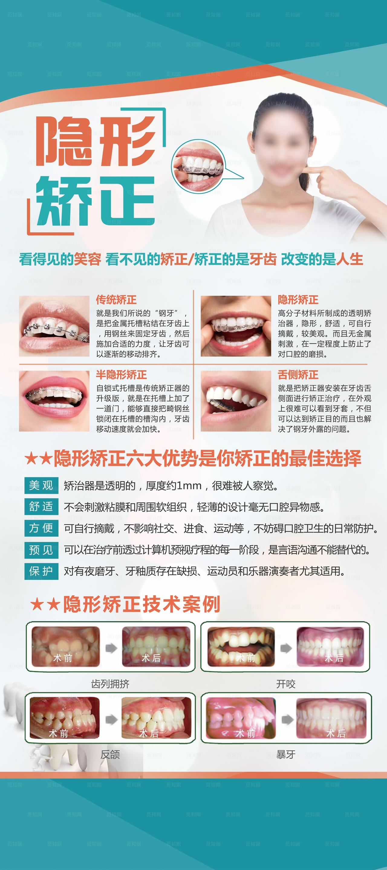 口腔医院牙齿矫正展架图片