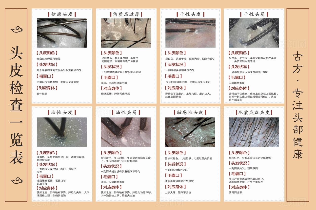 头皮检查一览表图片