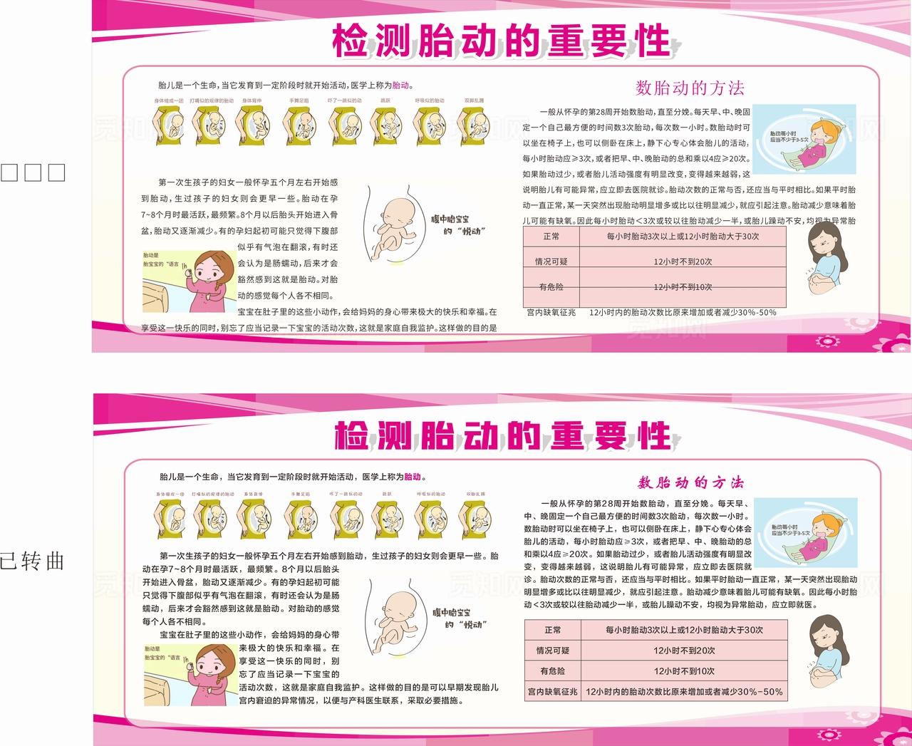 检测胎动的重要图片