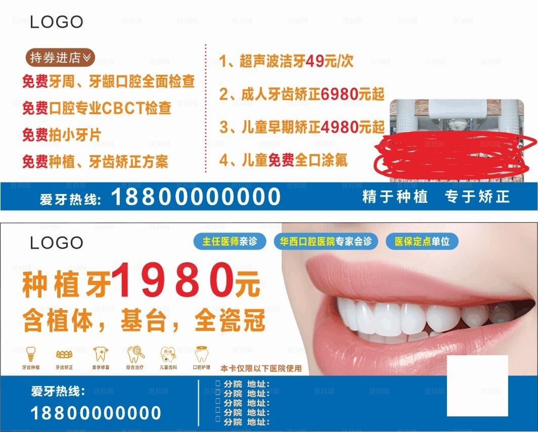 牙齿种植优惠广告图片