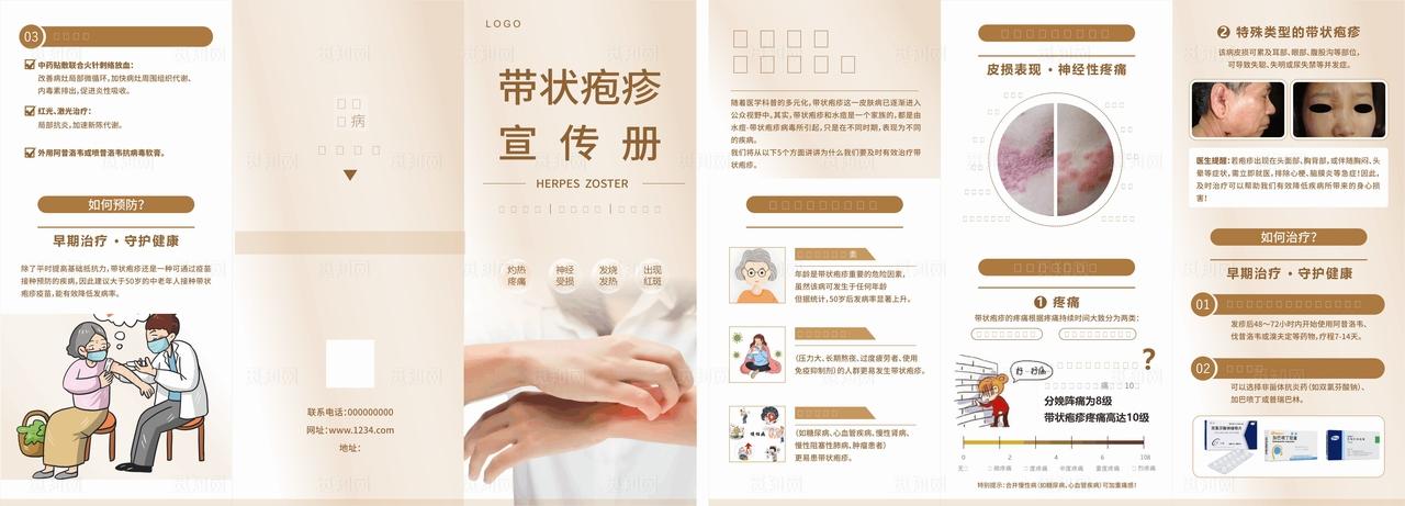 医院三折页带状疱疹图片