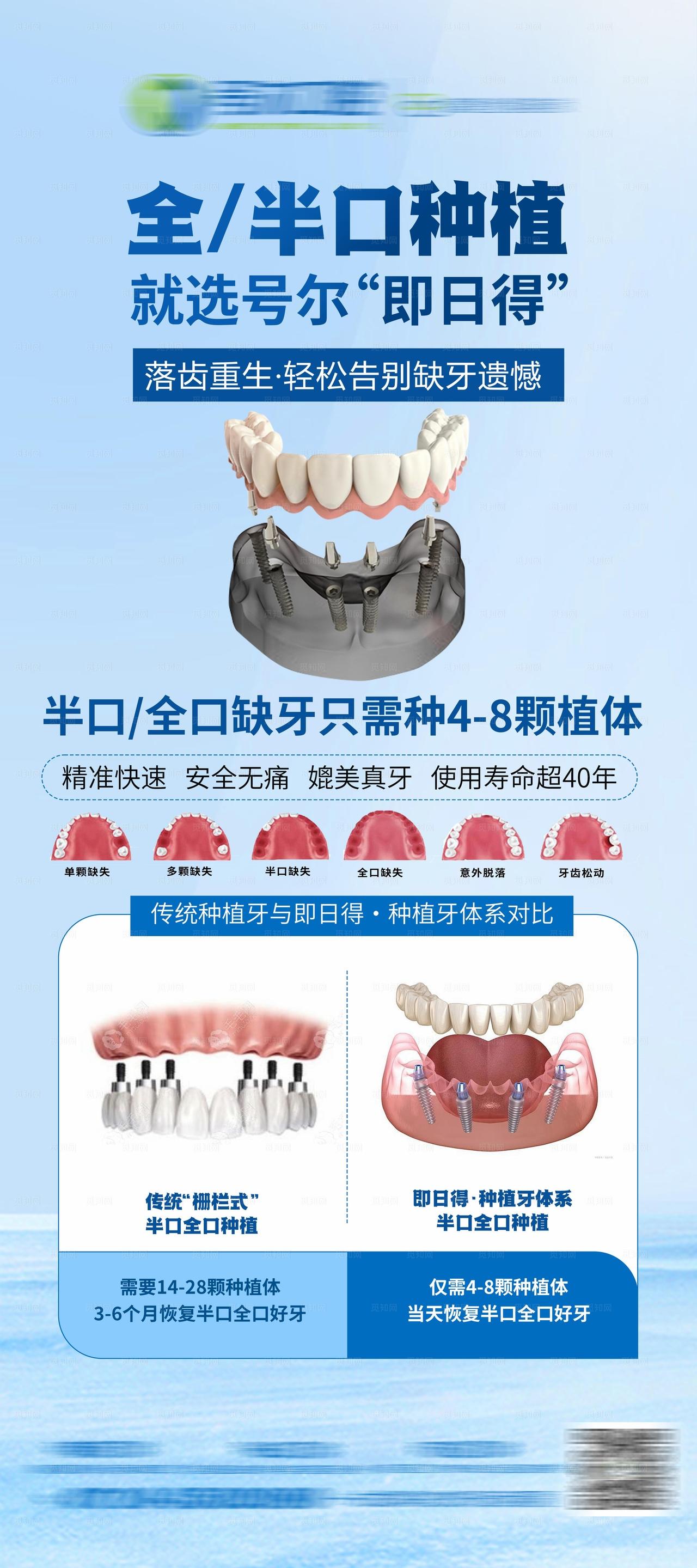 全口半口牙齿种植海报易拉宝图片