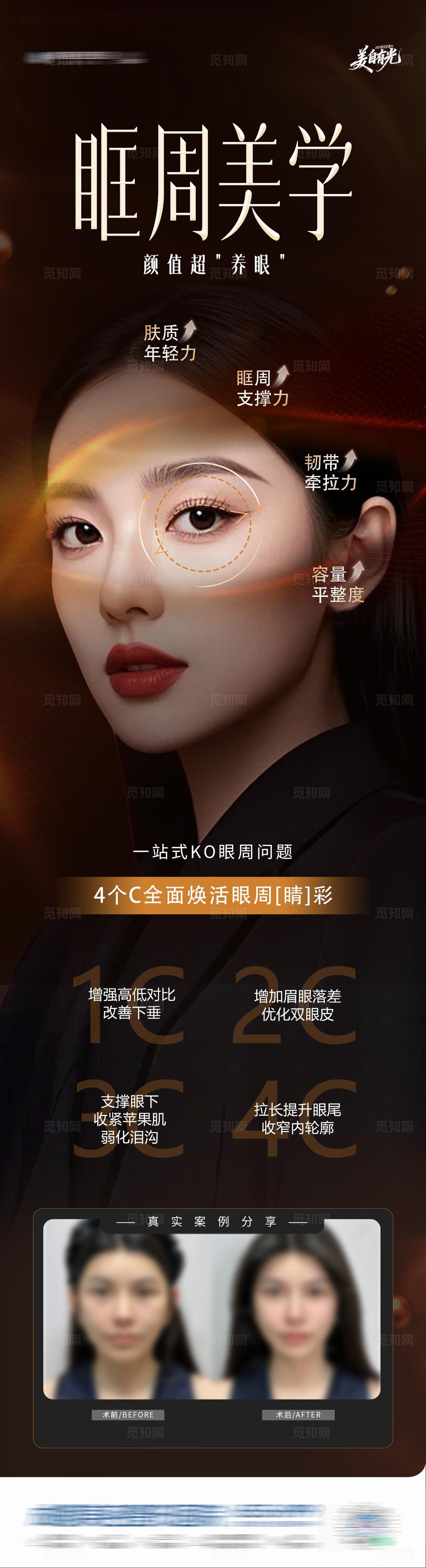 医美眼睛眶周美学眼周抗衰案例创意海报