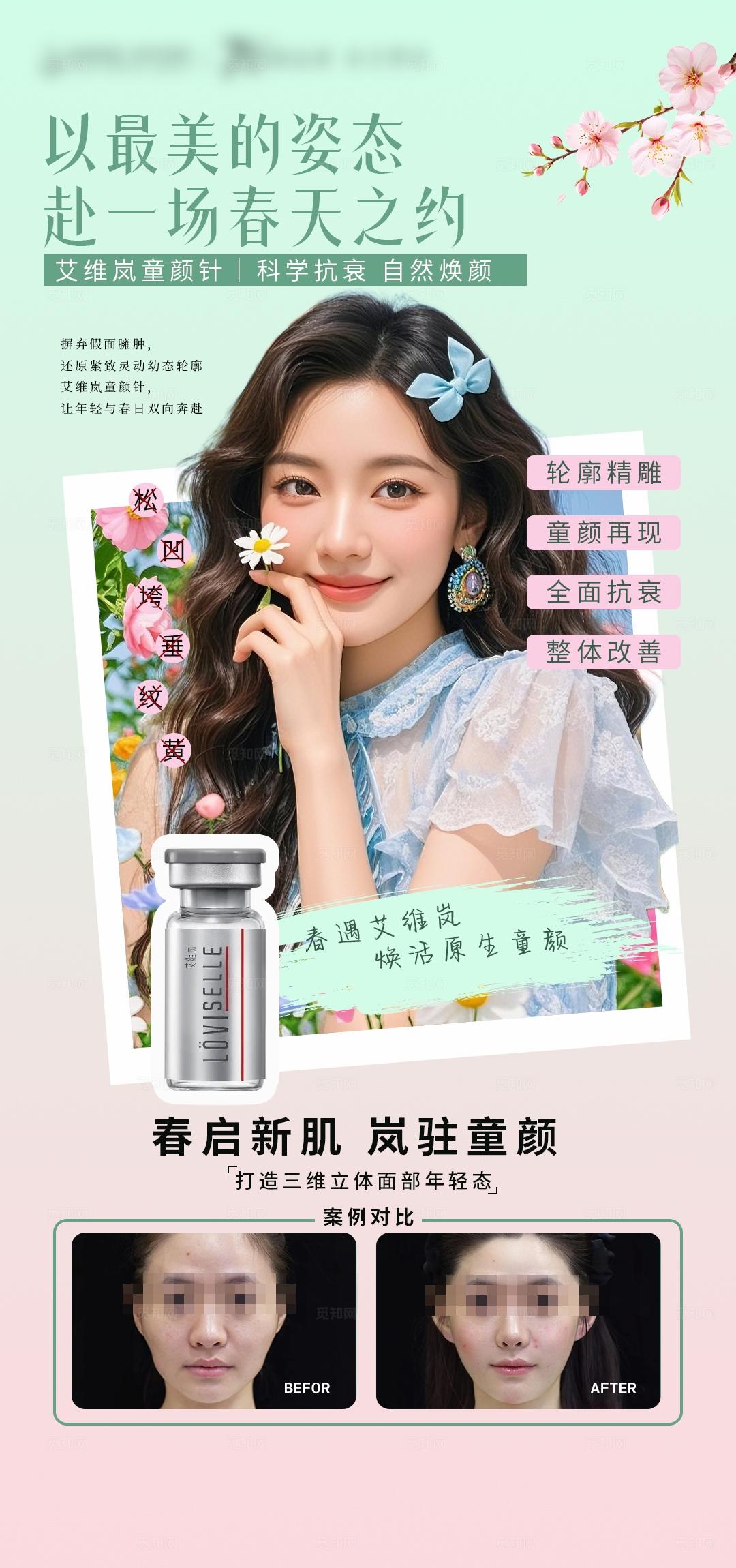 医美春日艾维岚童颜针海报