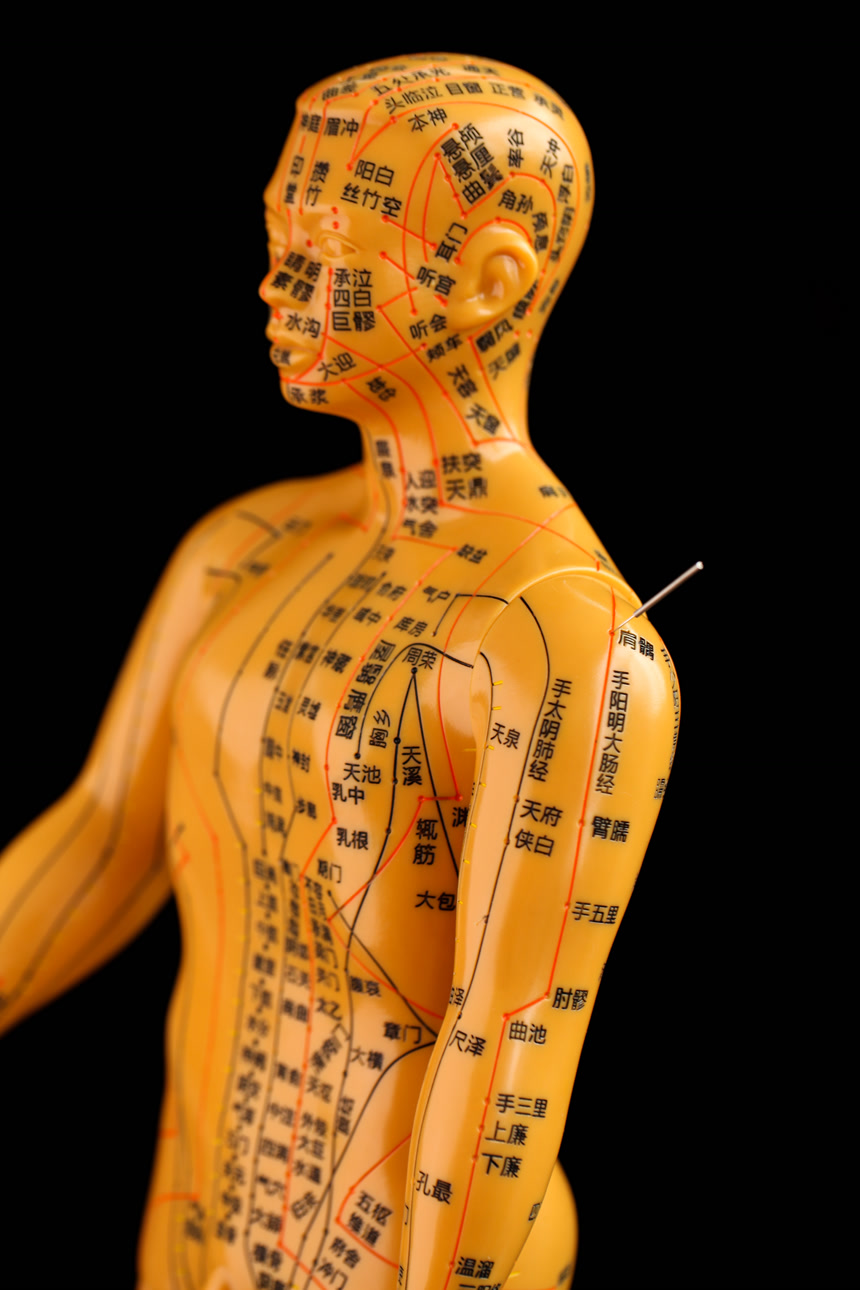 传统中医文化针灸穴位知识针灸