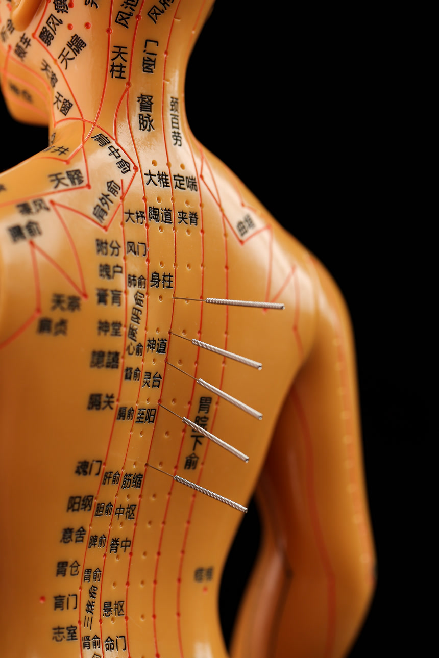 传统中医文化针灸穴位知识针灸