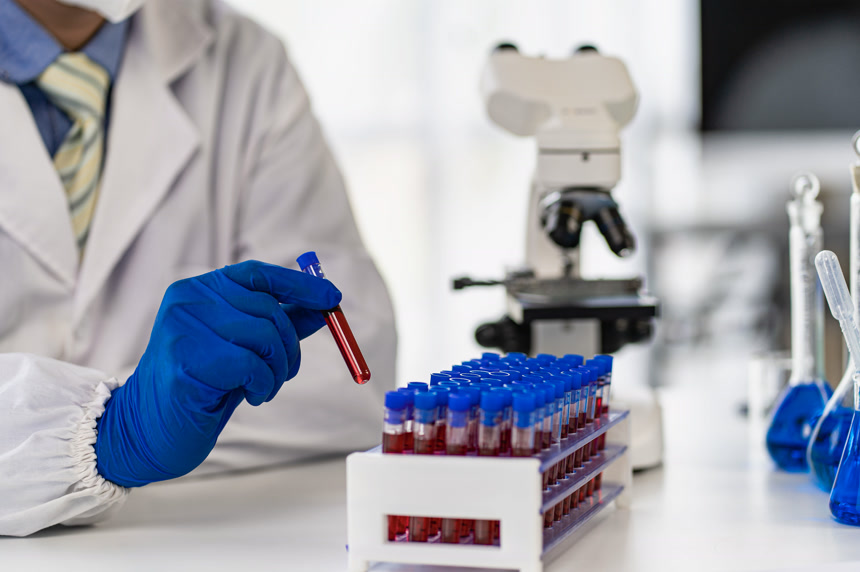 科学家手拿着一个装有血液的试管医学医疗