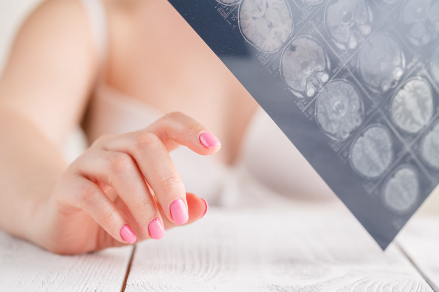 女性拿着射线相片观看健康医疗保健