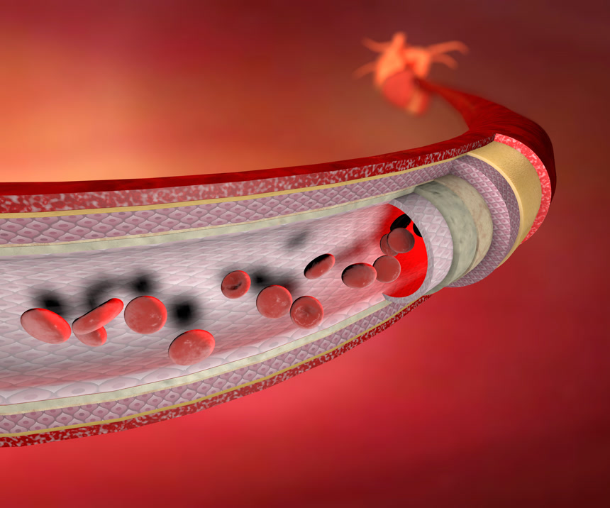 冠状动脉红色医疗健康科普背景