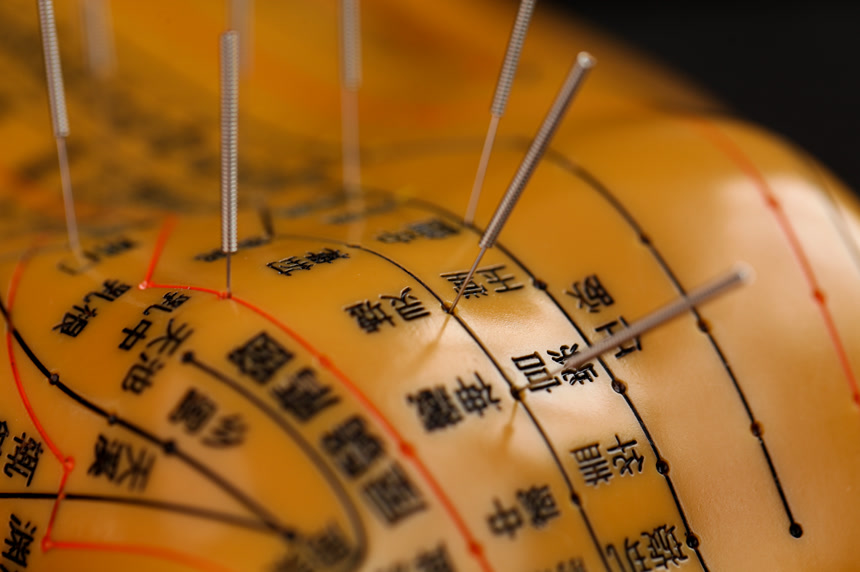 传统中医文化针灸穴位知识针灸