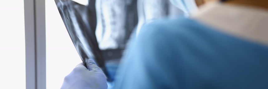 正在看片子的医生医疗人像