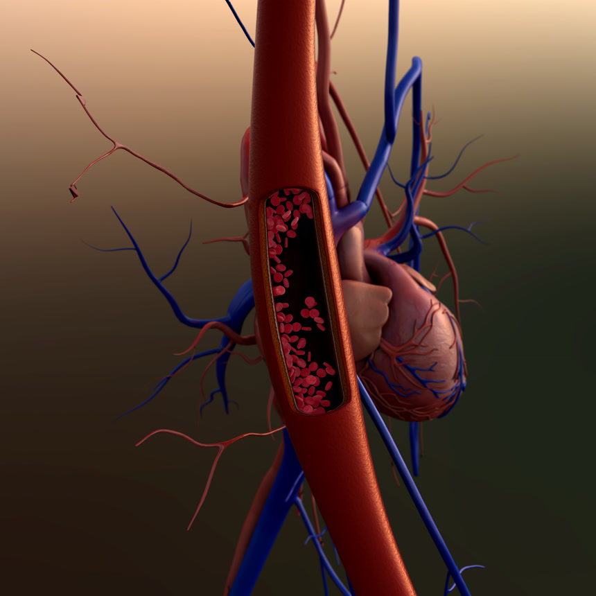动脉心3D模型健康保健医疗素材